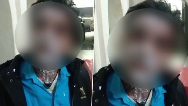 Uttar Pradesh Shocker: Wife Throws Acid on Husband in Kanpur After Verbal Spat (Disturbing Video)